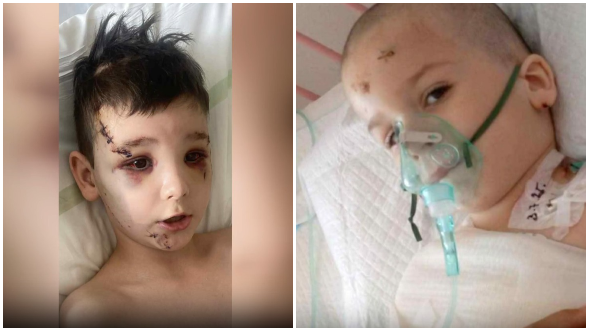 Patrik a Sebastián sú stále v nemocnici